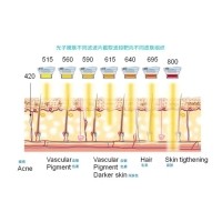 五大光子嫩膚技術(shù)（IPL、DPL、OPT、APT、BBL）及濾光片區(qū)別
